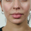 Image before
